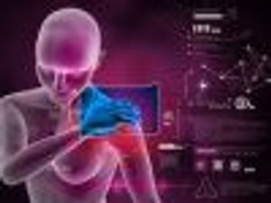 The Importance of Quick Relief in Rheumatoid Arthritis