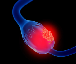 Credit: Lars Neumann - stock.adobe.com