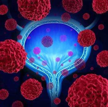 Bladder Cancer -- Image Credit: © freshidea - stock.adobe.com