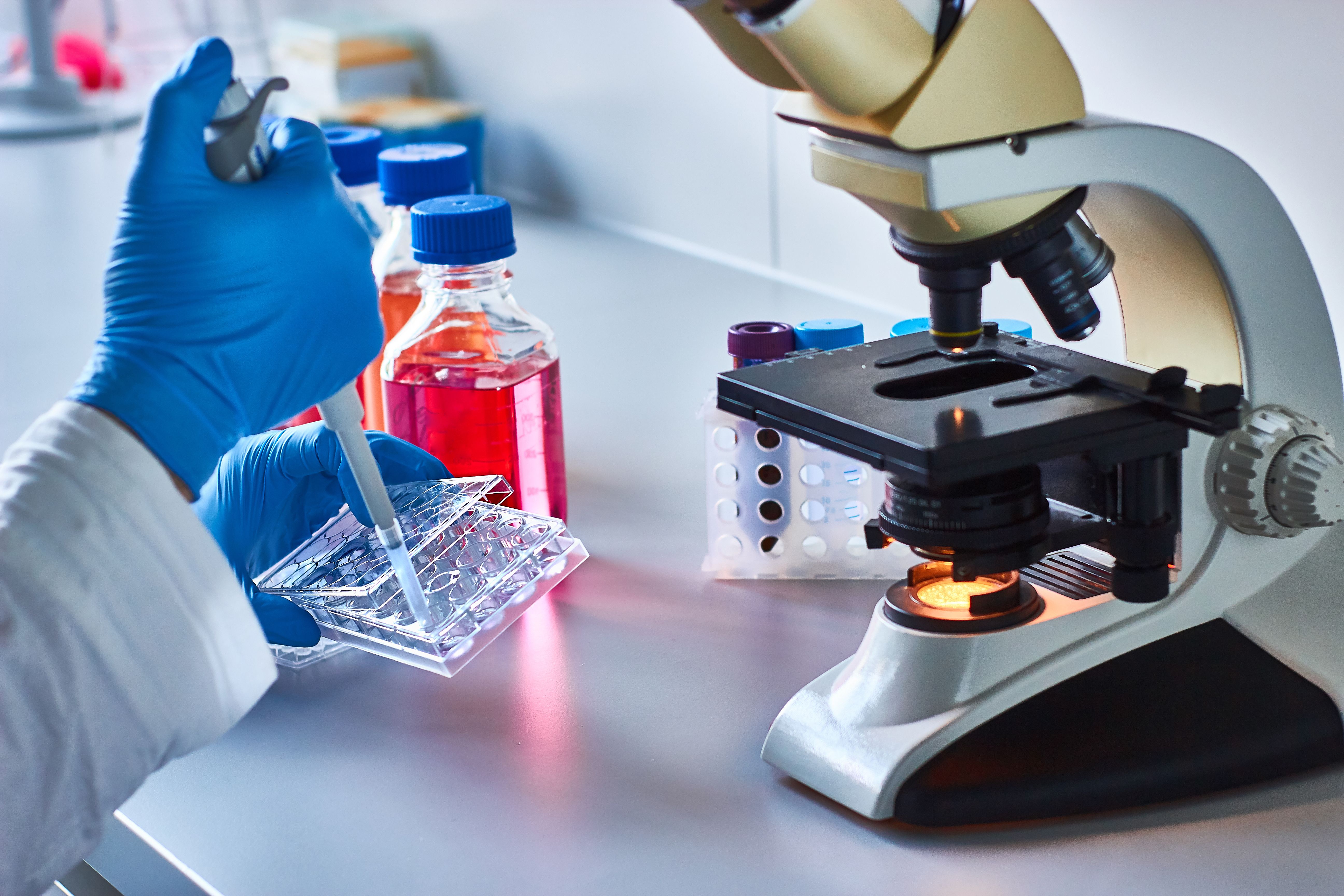 multiple myeloma stem cell therapy