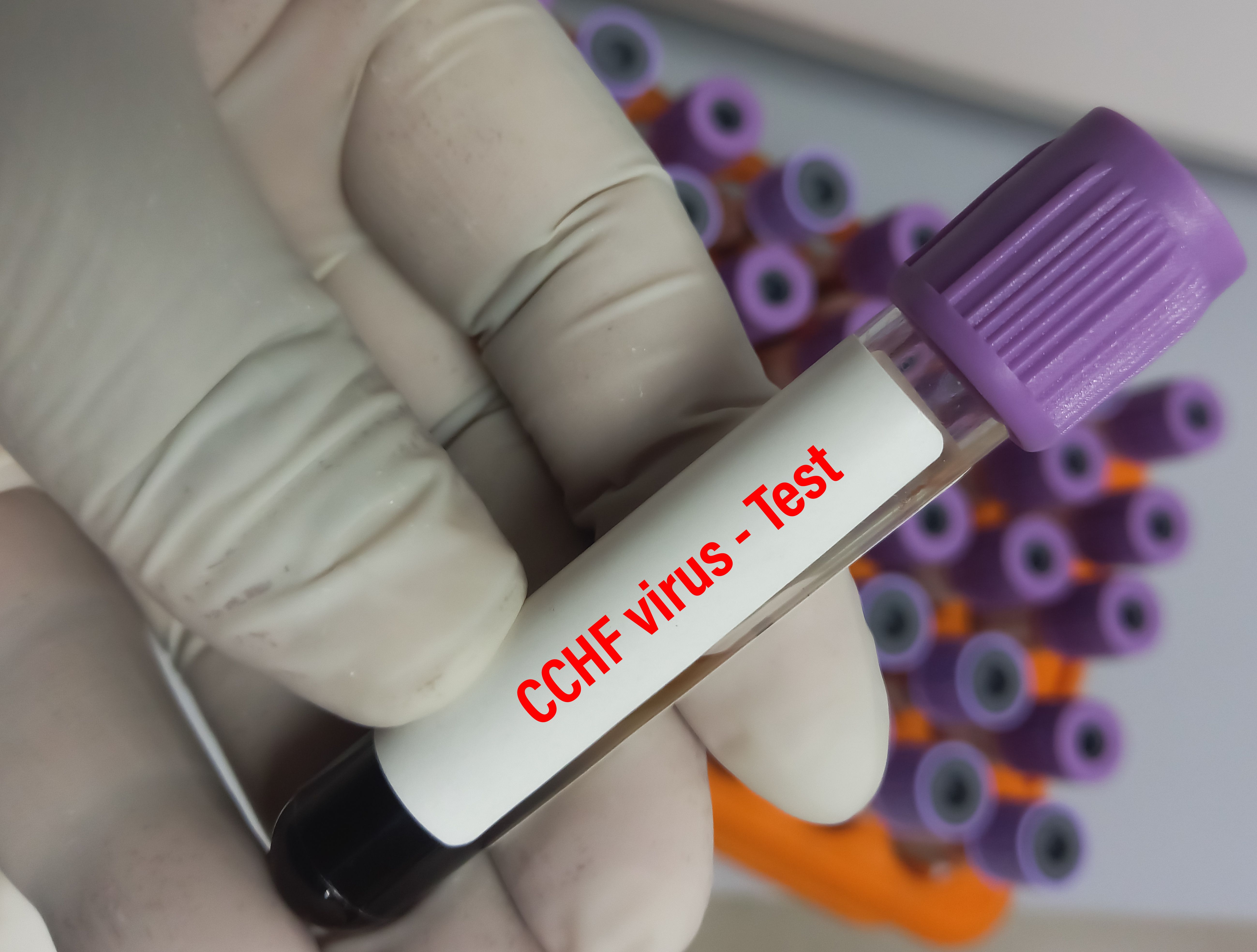 Blood sample for CCHF(Crimean Congo hemorrhagic fever) virus test, Nairobi sheep disease virus, Nairovirus test, Tick borne virus, Nosebleed fever. | Image Credit: MdBabul | stock.adobe.com