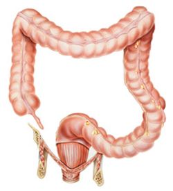 FDA Grants Priority Review to Tucatinib With Trastuzumab to Treat HER2 Colorectal Cancer