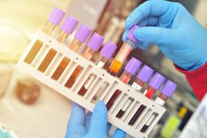 Subcutaneous Isatuximab Gains Approval for MM in Japan Ahead of Anticipated FDA Decision