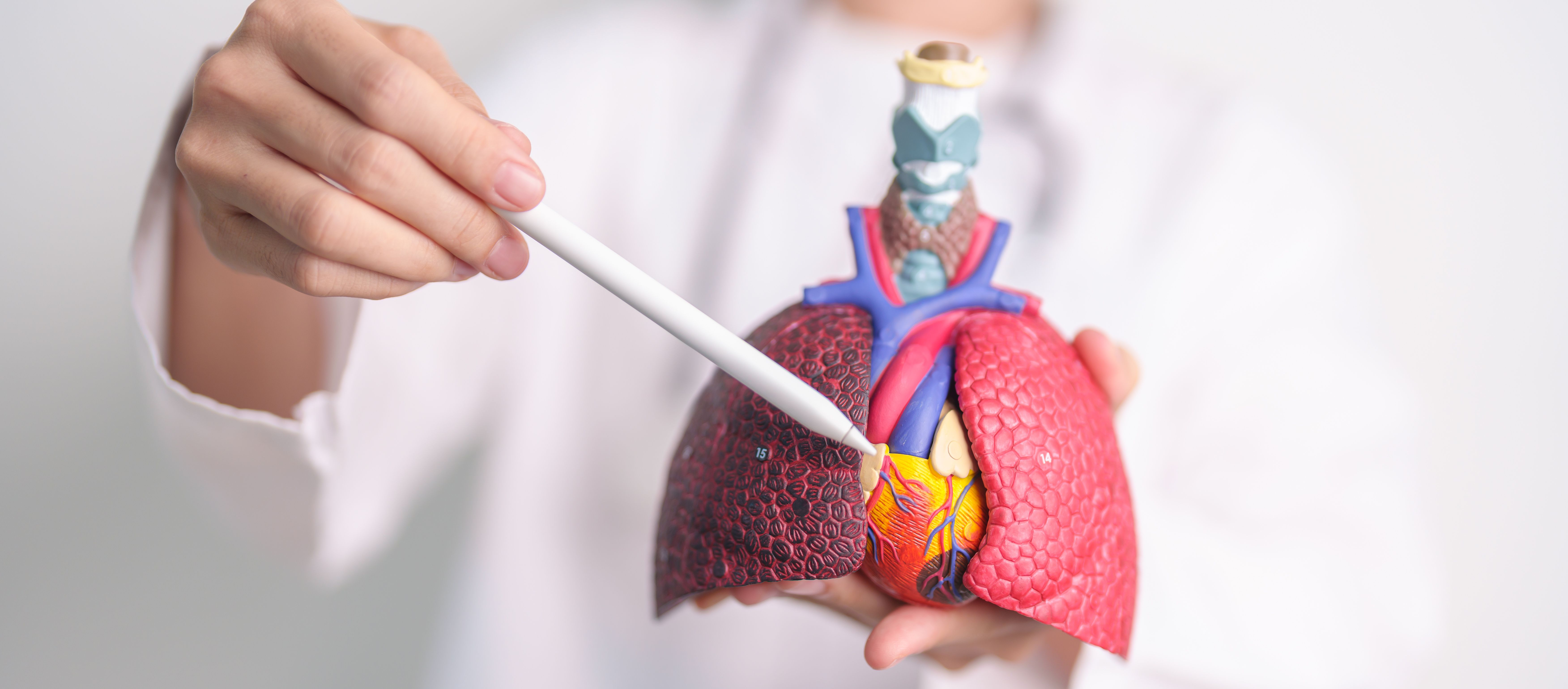 Model of lungs affected with bronchiectasis -- Image credit: Jo Panuwat D | stock.adobe.com
