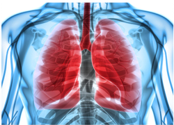 Osimertinib Significantly Improves Disease-Free Survival in EGFR-Mutated Lung Cancer