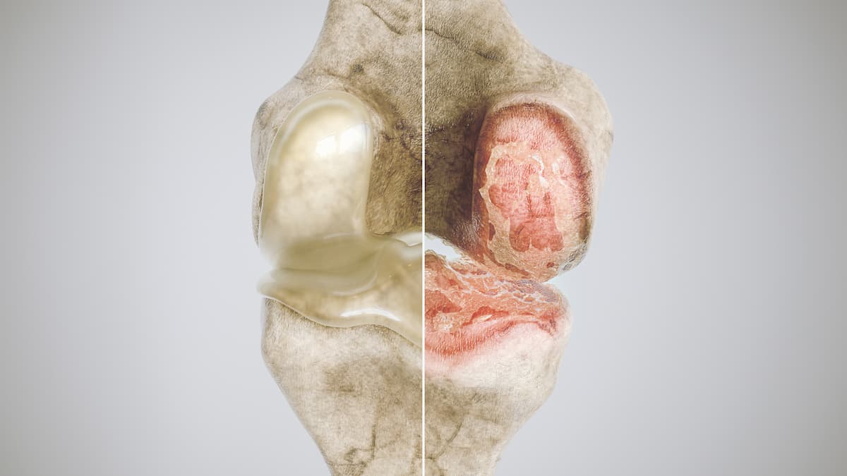 FDA Grants Fast Track Designation to Potential Gene Therapy for ...