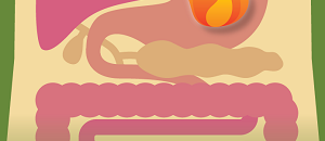 Gut Feelings: Irritable Bowel Syndrome and Inflammatory Bowel Disease