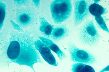 Human prostate cancer cells.
