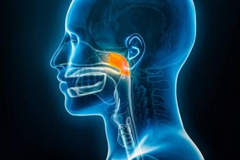 Nasopharyngeal carcinoma -- Image credit: Matthieu | stock.adobe.com