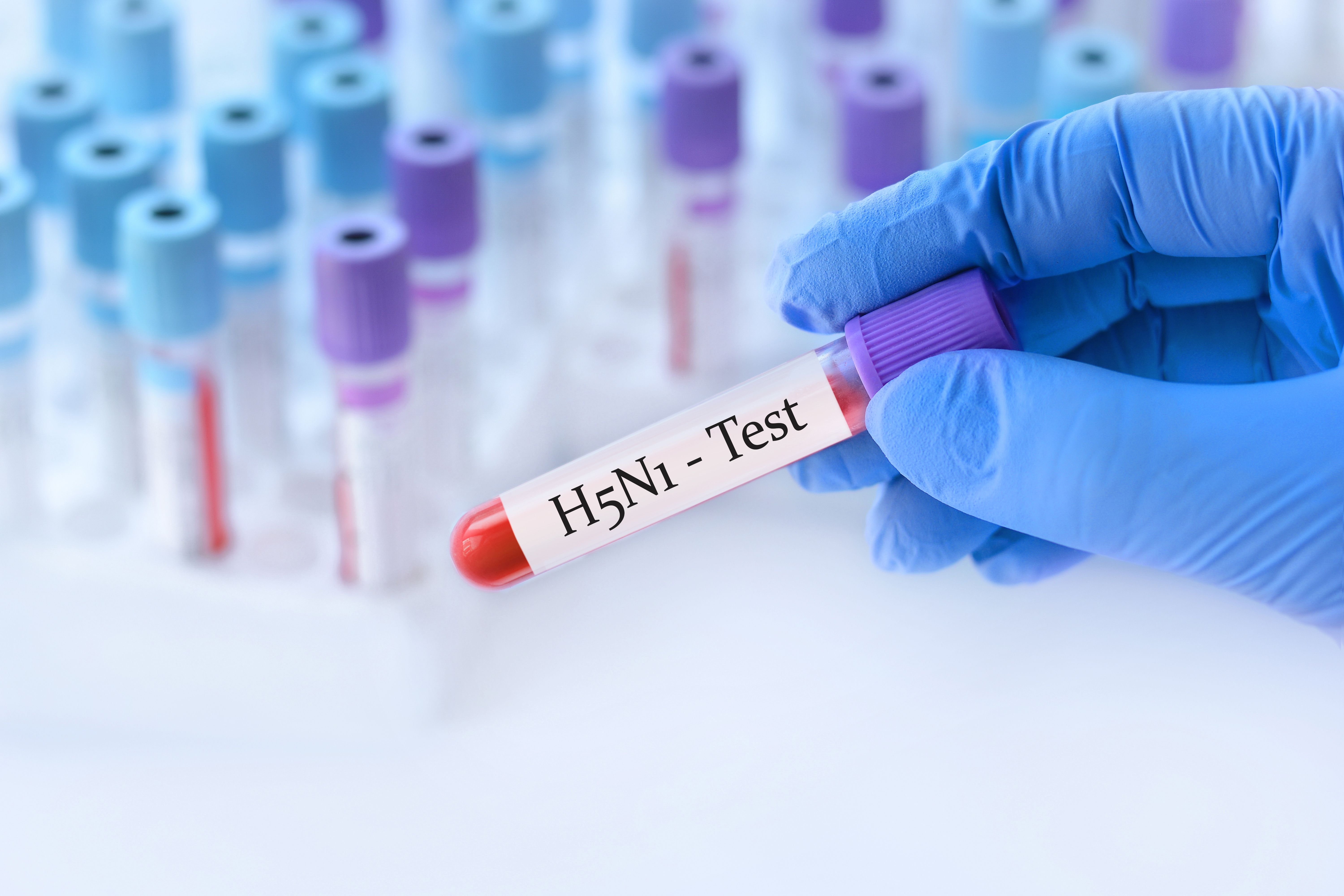 H5N1 blood test | Image Credit: © syhin_stas - stock.adobe.com