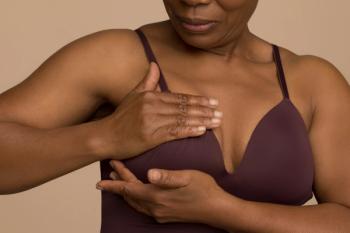 Woman conducting self breast exam -- Image credit: Cultura Creative | stock.adobe.com