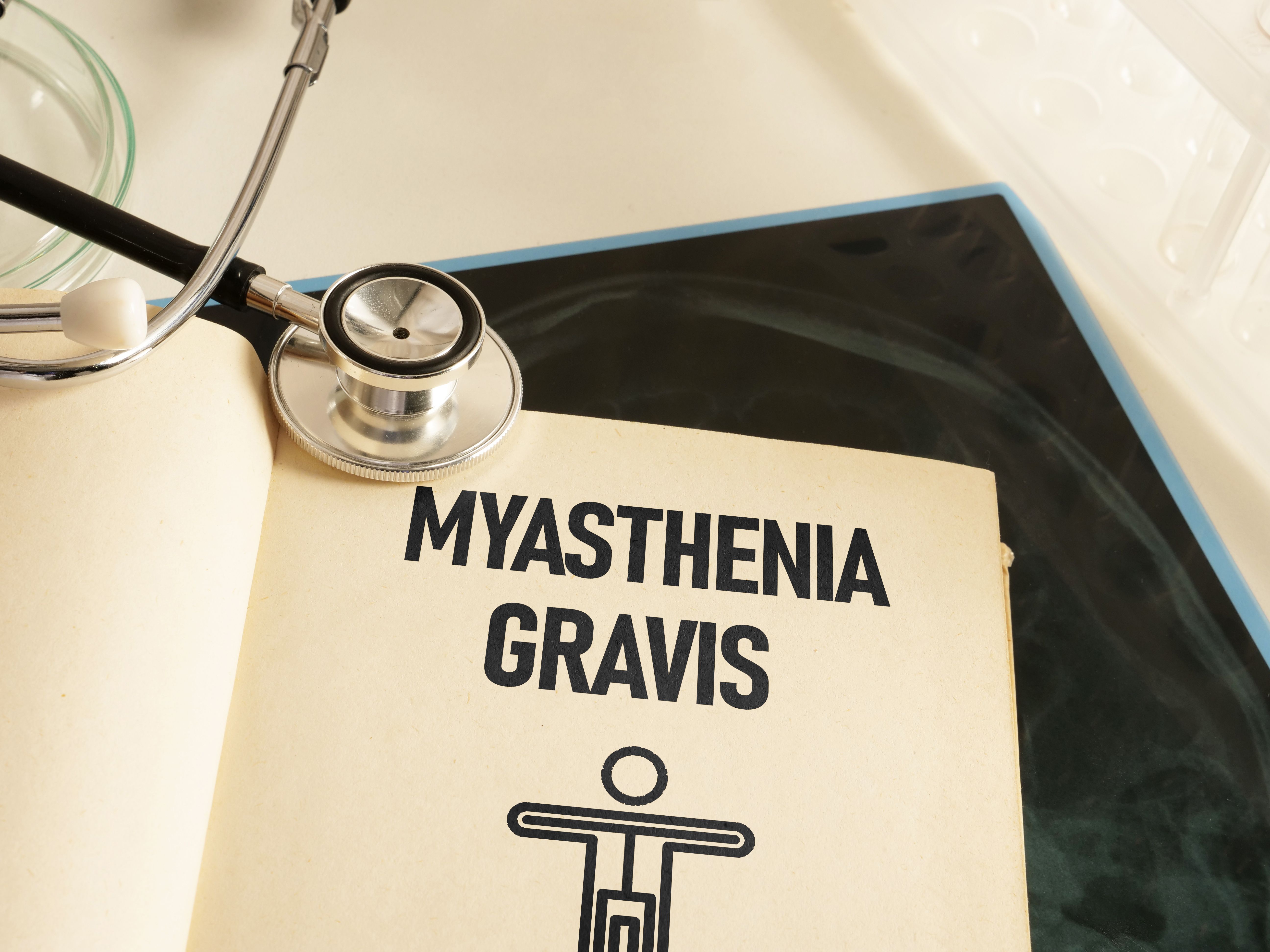 Myasthenia gravis -- Image credit: Andrii | stock.adobe.com