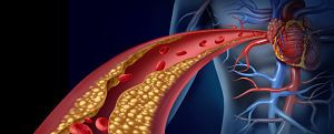 Phytosterols for Lowering Cholesterol: Pharmacy Interventions to Improve Patient Outcomes