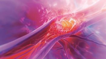 Illustration of myocardial infarction - Image credit: Acute Coronary Syndrome | stock.adobe.com