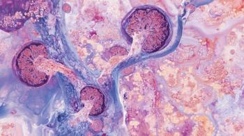 AI-generated depiction of chronic kidney disease (CKD) -- Image credit: Maqsood | stock.adobe.com