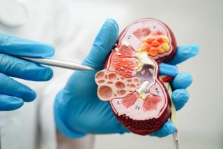 Chronic kidney disease, doctor holding model for treatment urinary system, urology, Estimated glomerular filtration rate eGFR. | Image Credit: manassanant | stock.adobe.com
