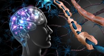 Multiple sclerosis nerve disorder.