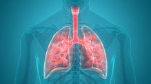 GOLD guidelines providing recommendations for the management of COPD