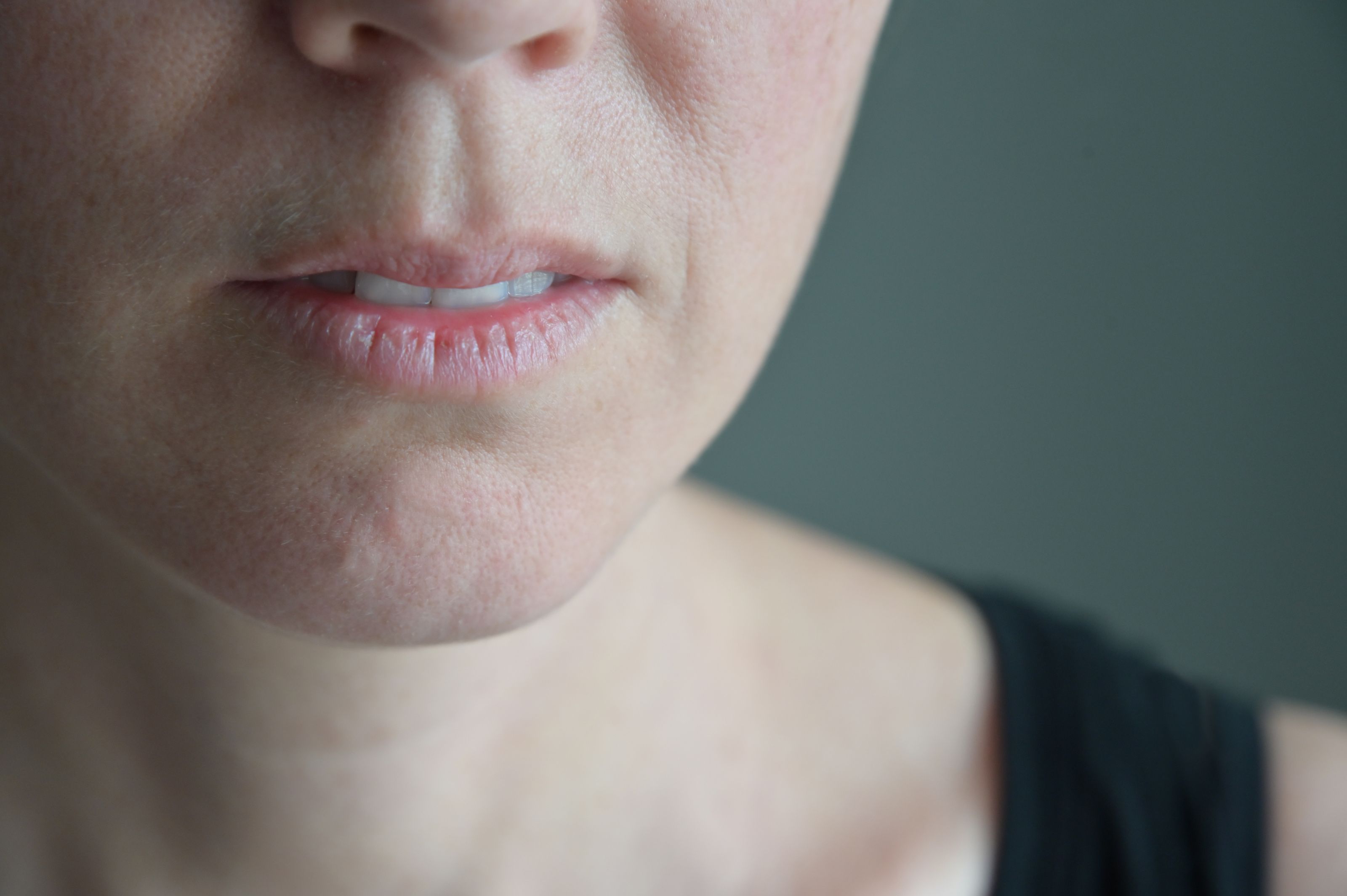 Woman with dry mouth -- Image credit: Rafael Ben-Ari | stock.adobe.com