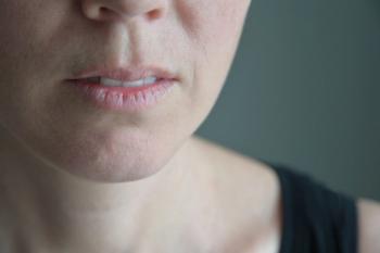 Woman with dry mouth -- Image credit: Rafael Ben-Ari | stock.adobe.com