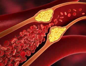 High cholesterol -- Image credit: peterschreiber.media | stock.adobe.com