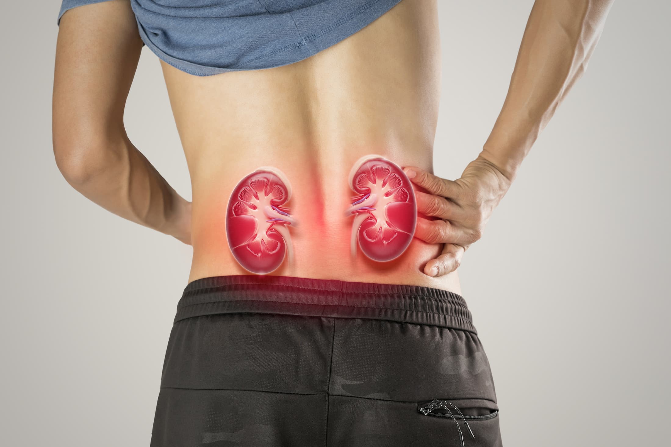 Image shows lower back kidney pain, a common symptom of chronic kidney disease or acute renal failure. Early diagnosis and nephrology care can help slow disease progression