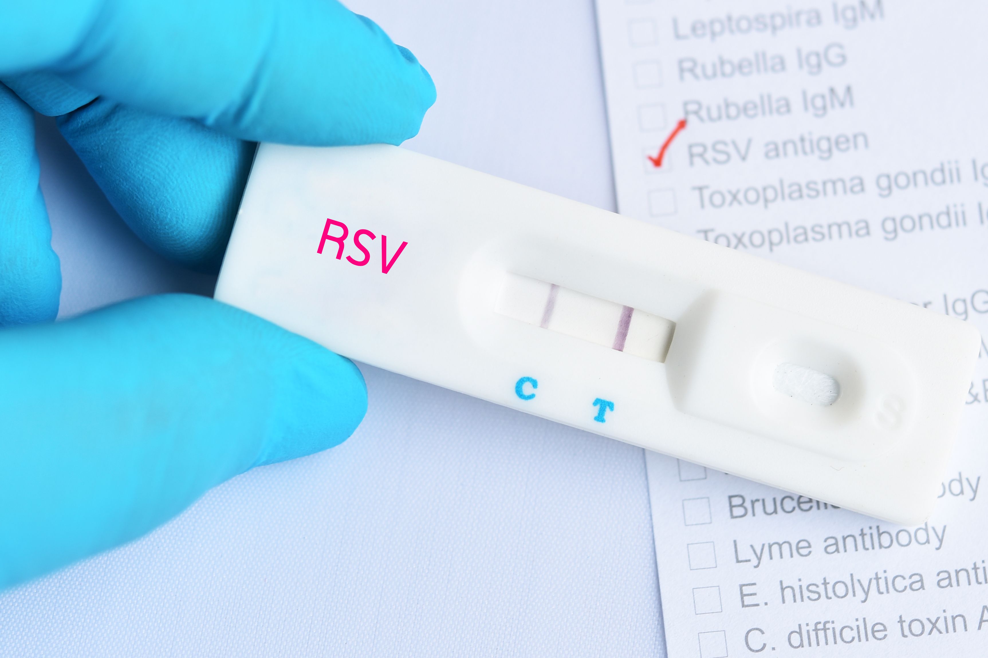 RSV positive test result by using rapid test cassette, diagnosis for respiratory disease - Image credit: jarun011 | stock.adobe.com