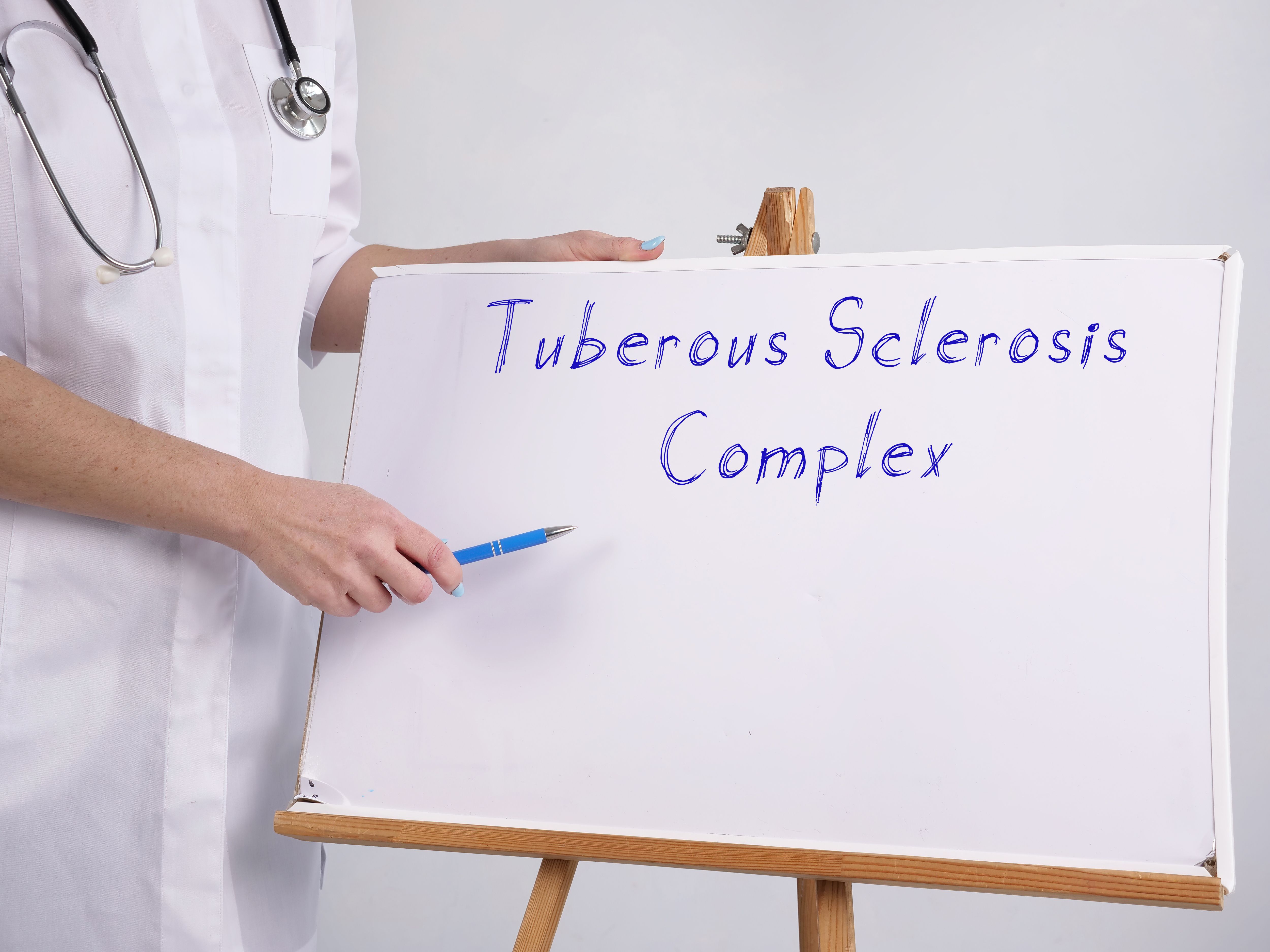 Tuberous sclerosis complex written on easel | Image Credit: © Yurii Kibalnik - stock.adobe.com