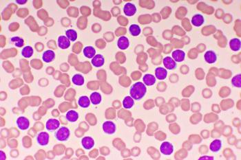 Chronic lymphocytic leukemia -- Image credit: jarun011 | stock.adobe.com