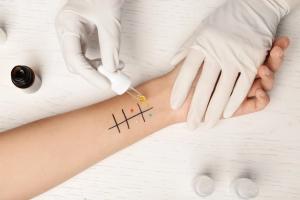 Pharmacists Should Be Recommending Penicillin Allergy Testing