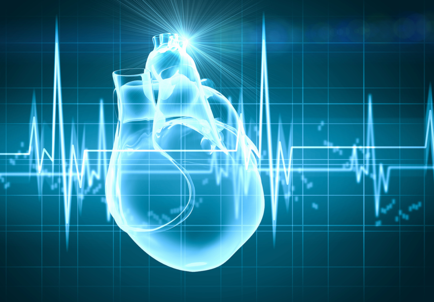 Cardiorenal events account for the majority of healthcare costs in patients with heart failure