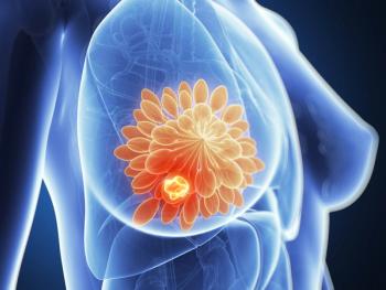 The FDA's approval of sacituzumab govitecan-hziy for first-line metastatic triple-negative breast cancer marks the first new backbone therapy option for this aggressive disease in more than two decades. Credit: Stock.Adobe.com/Sebastian Kaulitzki.