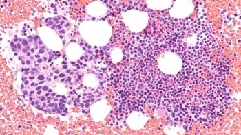 FDA approval moves Tukysa into the first-line maintenance setting for HER2+ breast cancer following induction treatment, though overall survival data from the phase 3 trial remain pending. Credit: Stock.Adobe.com/David A Litman.