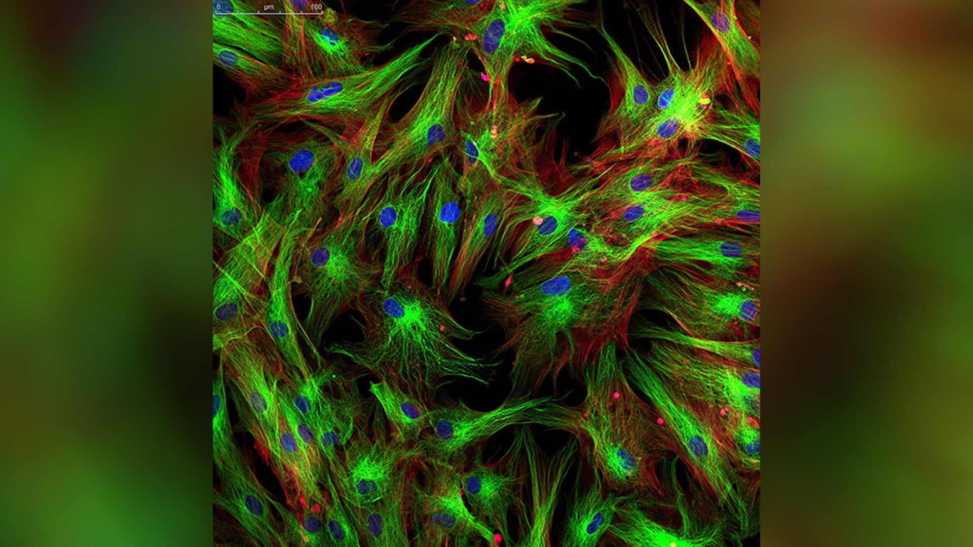 FibroBiologics