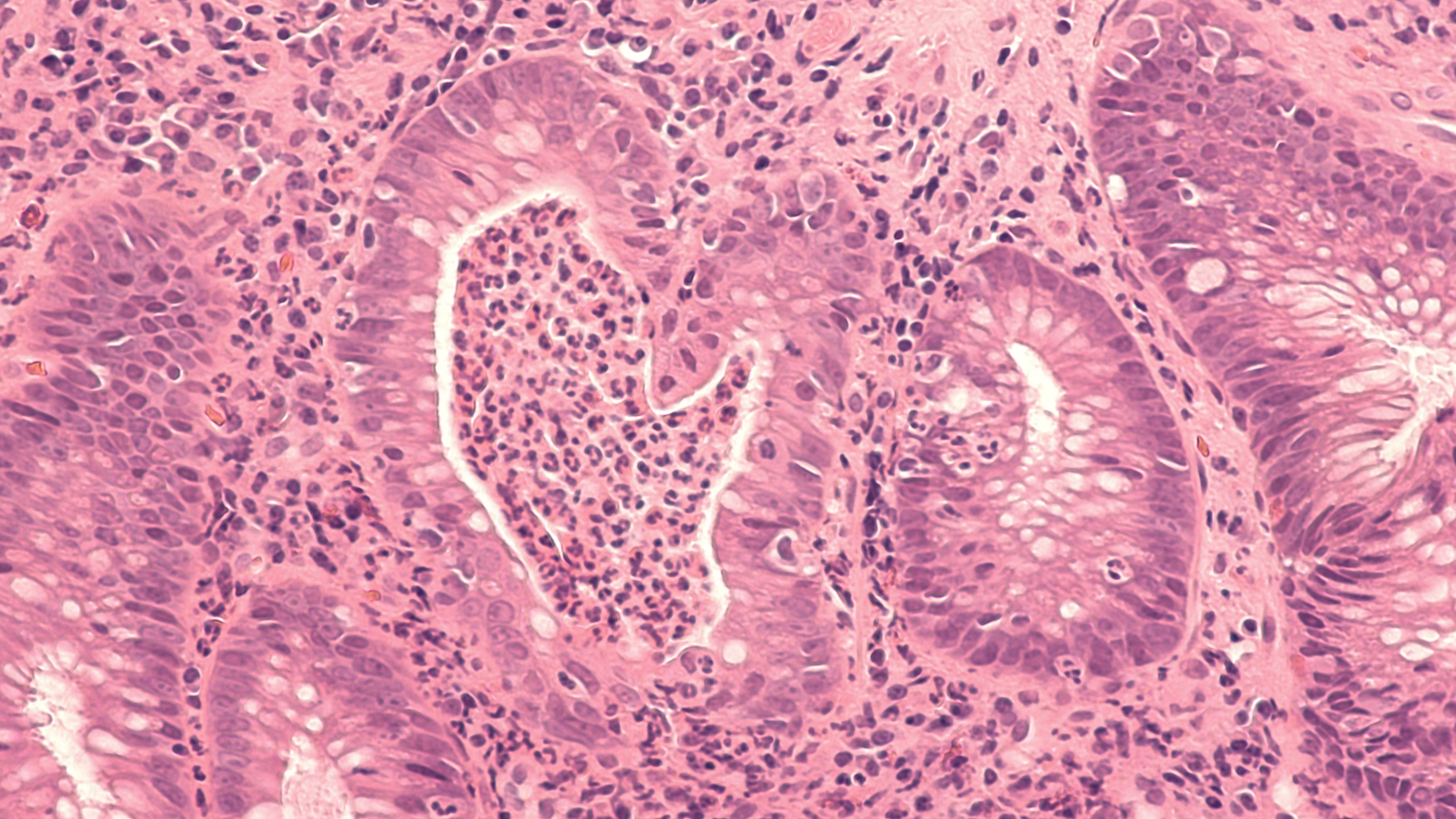 Image Credit: Adobe Stock Images/David A Litman