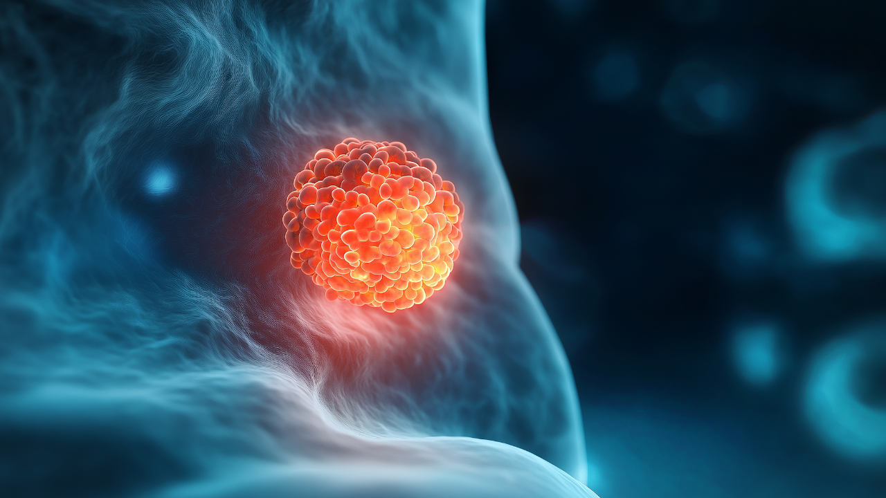 Gilead, Kymera Launch Collaboration on Novel Oral CDK2 Degraders for Solid Tumors
