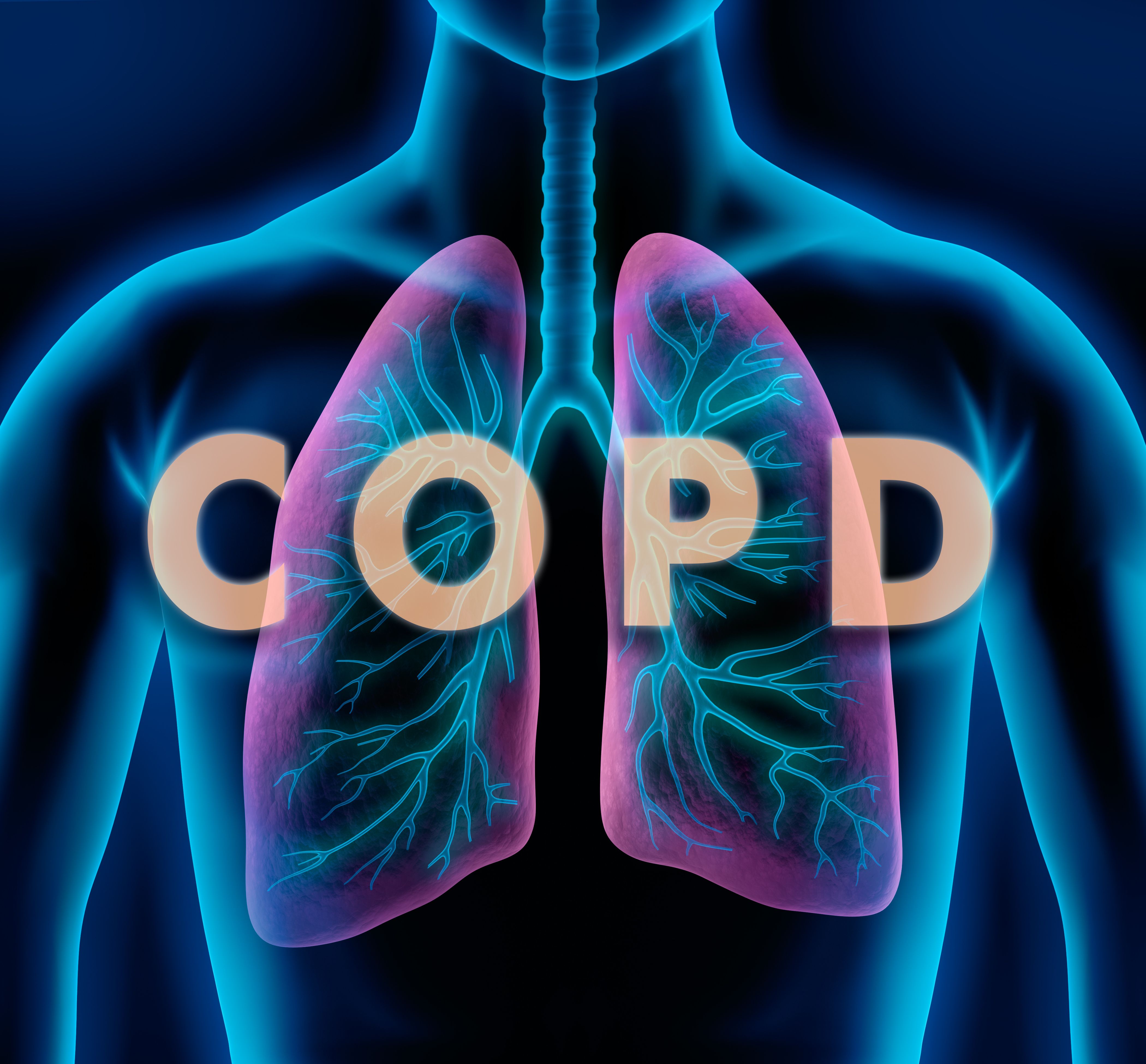 Image credit: peterschreiber.media | stock.adobe.com. Motiv COPD - Lunge und Bronchien
