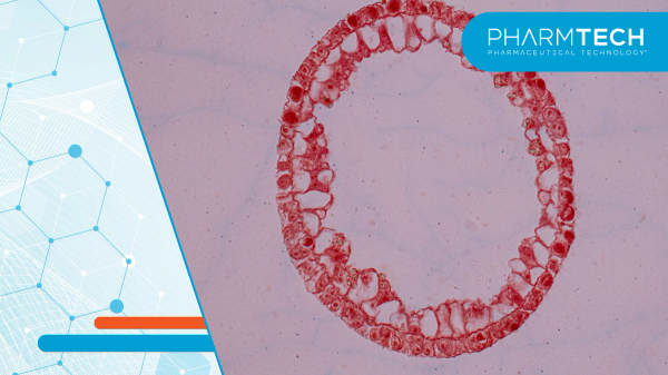 What professionals need to know about the hold of RGX-121 (clemidsogene lanparvovec)for Mucopolysaccharidosis type II (MPS II), also known as Hunter Syndrome by the FDA