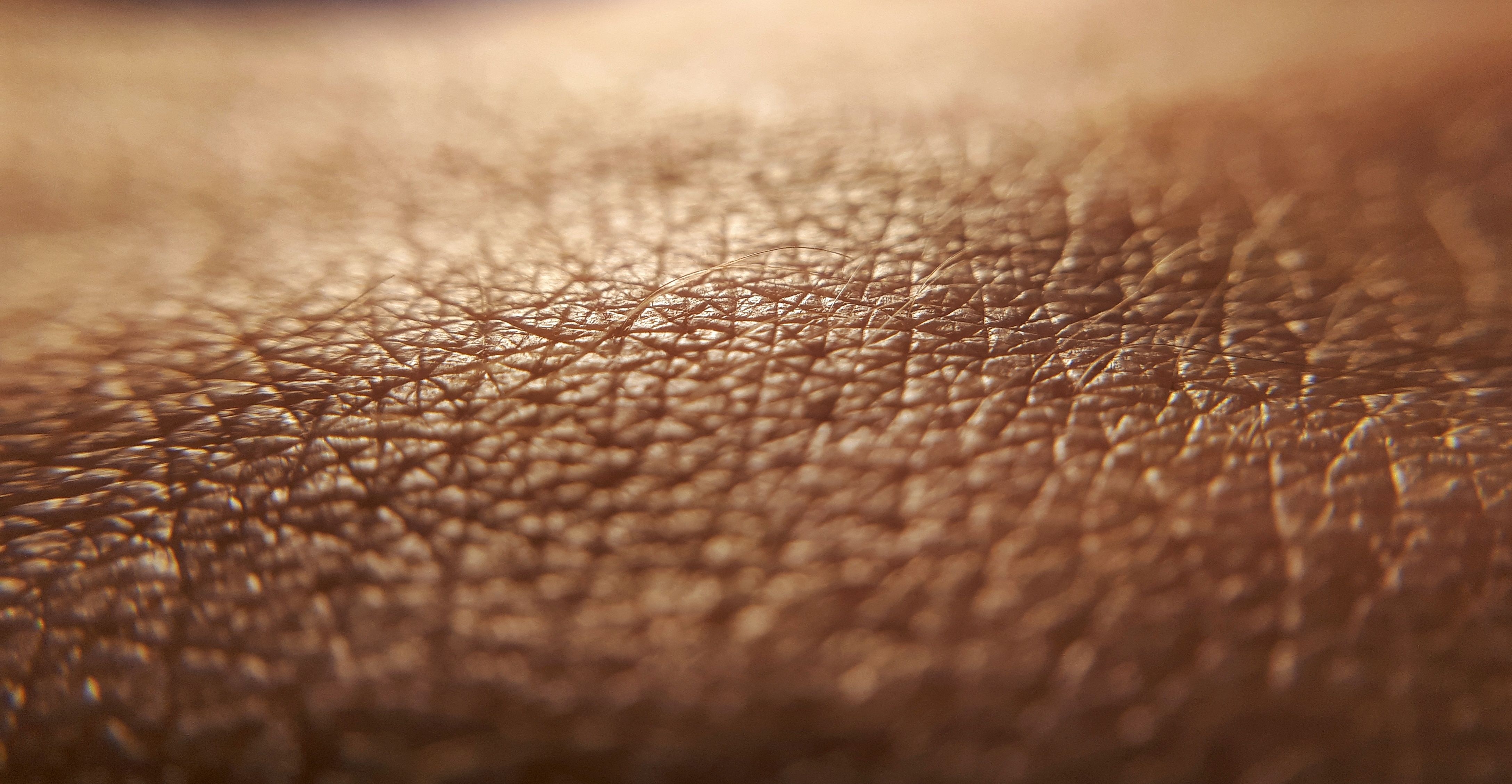 Skin diseases concept. macro skin of human hand.Medicine and dermatology concept. Details of human skin background. | Image Credit: © daily_creativity - stock.adobe.com