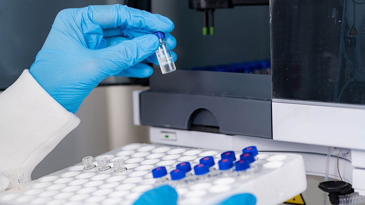 Liquid Chromatography Research | Image Credit: ©Microgen -stock.adobe.com