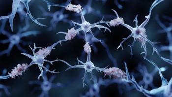 Amyloid plaques in Alzheimer's disease | Image Credit: ©Artur -stock.adobe.com