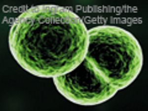 Single-Use Redundant Filtration