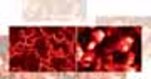 Improving the stability of a suspension