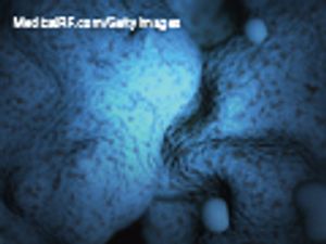 Embryonic stem cells: the moral dilemma of patentability and funding