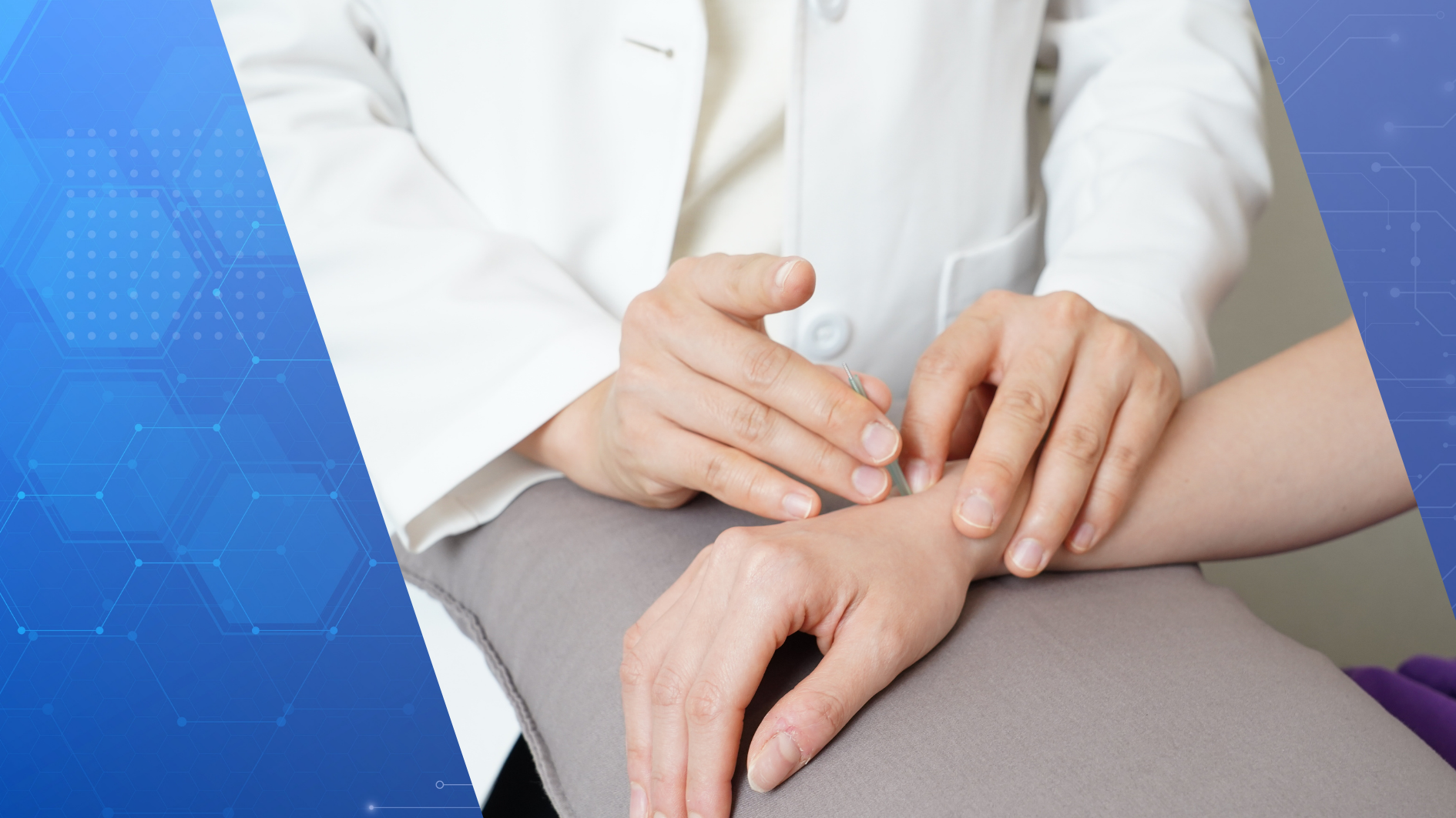 FDA Accepts Tildrakizumab-asmn | Created with Canva