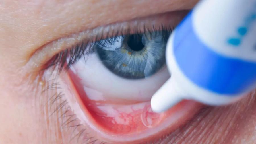Aiming for Improved Efficacy and Patient Compliance for Topical Ophthalmics; Image: revers_jr - stock.adobe.com