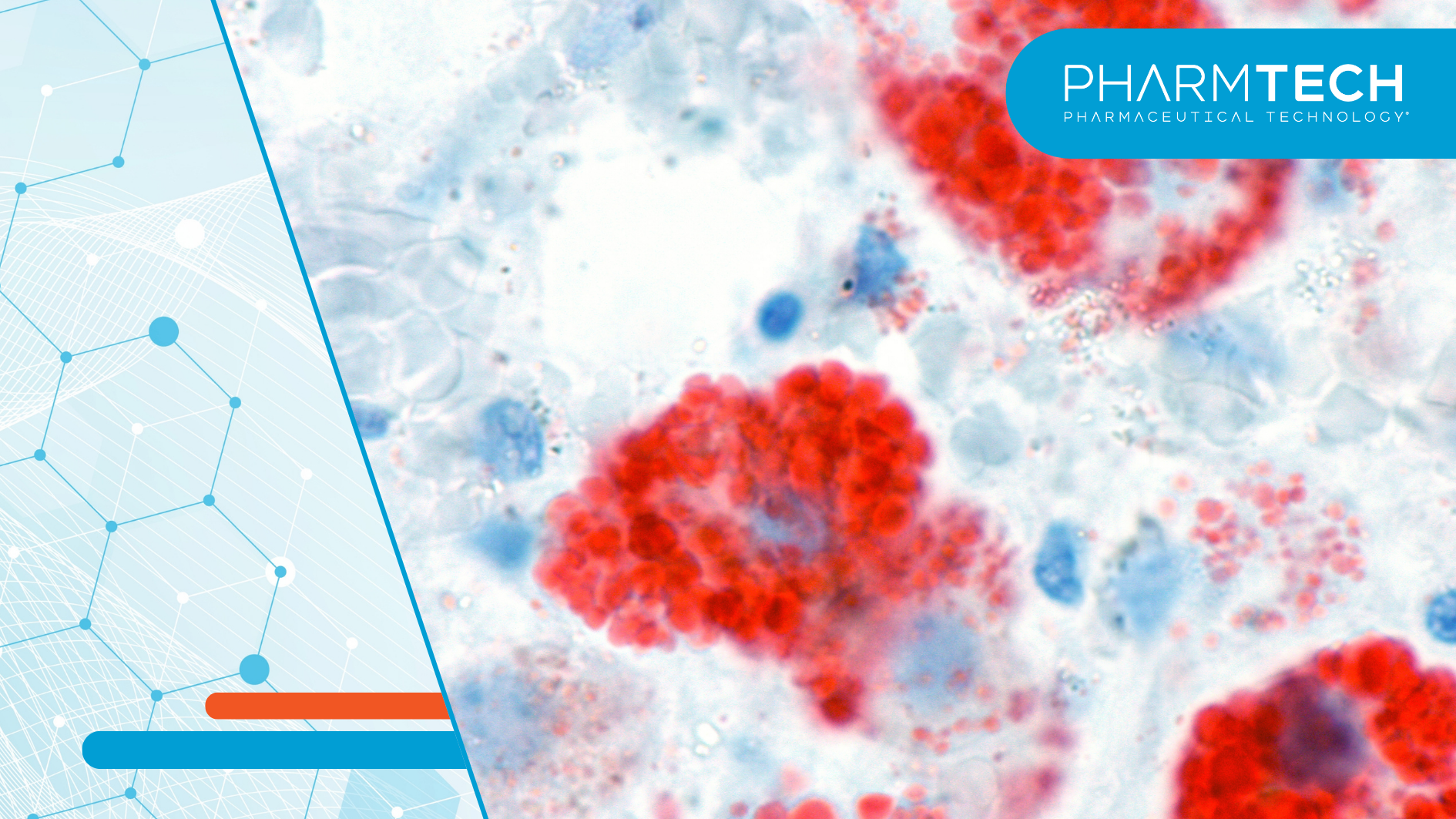 A treatment for erythropoietic protoporphyria and X-linked protoporphyria is pending approval from the FDA.