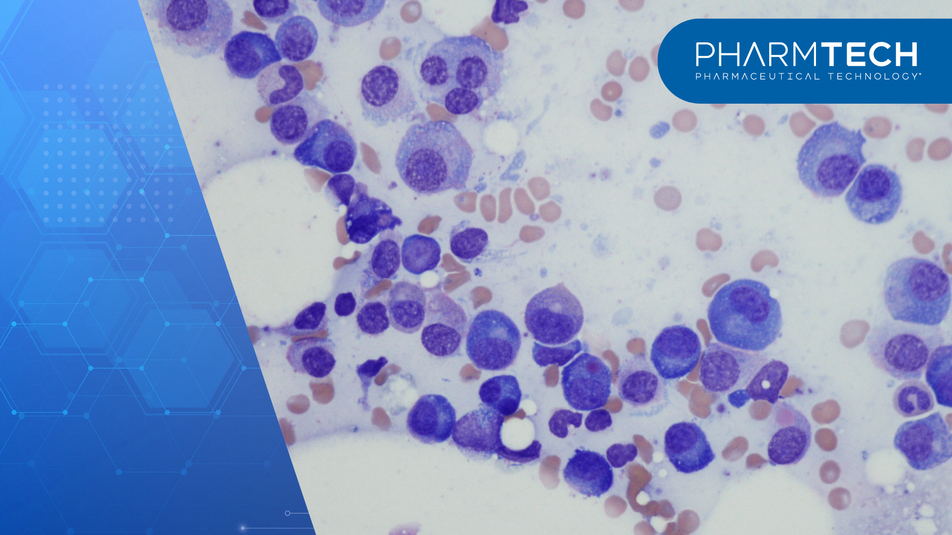 Sarclisa Escena is subcutaneous injection designed for 3 multiple myeloma treatment combinations