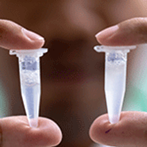 How Advanced Mass Spectrometry Technologies and Workflows are Providing Complete Protein Characterization