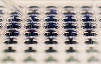 mainimage-laboratory-assay-in-a-microtiter-plate-gettyimages.jpg